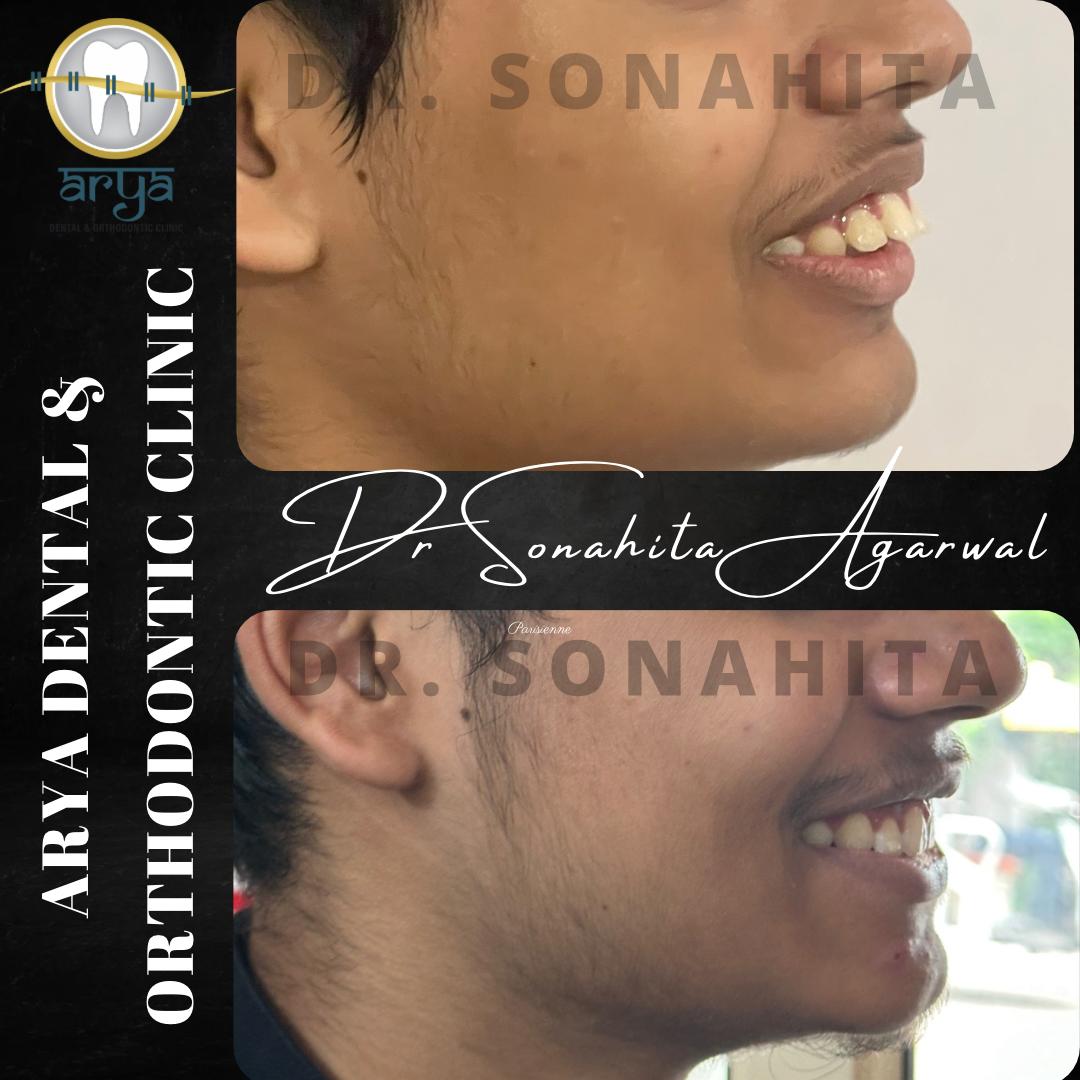 Patient smile transformation 5